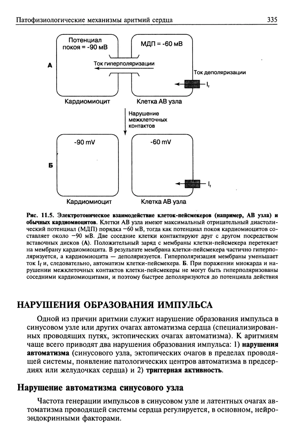 Нарушения образования импульса