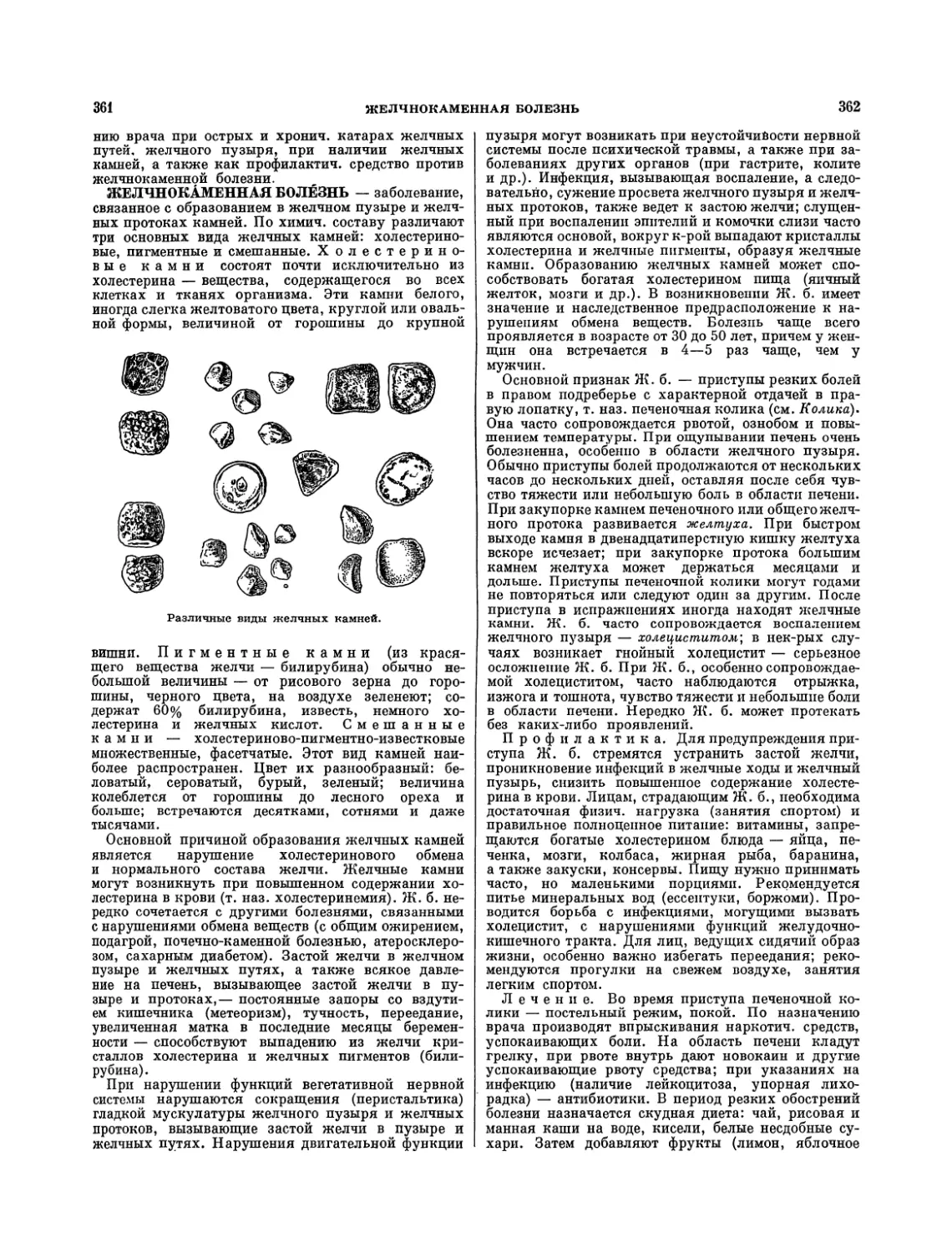 Желчнокаменная болезнь — В. И. Кристман