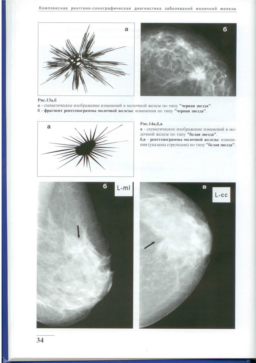 Маммография норма и патология снимки