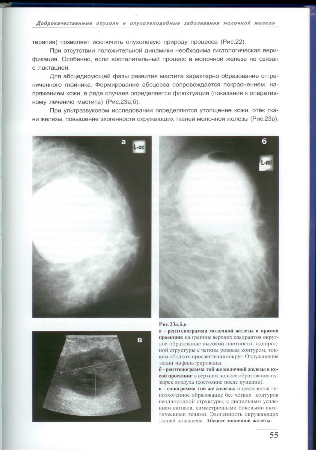Анализ маммографии. Заключение маммография молочных желез норма. Норма молочной железы маммограмма. Показатели маммографии в норме. Маммография норма и патология.