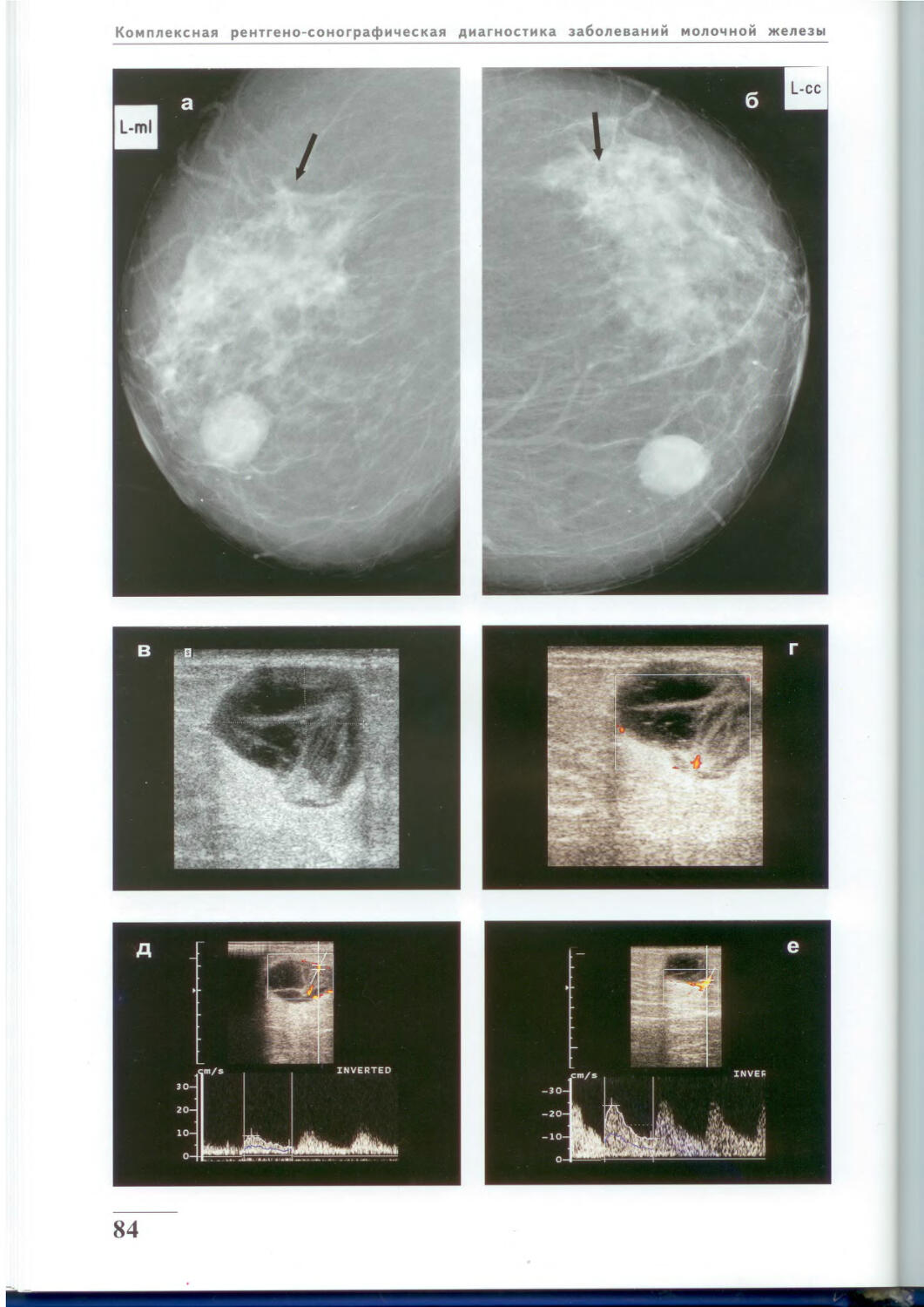 Маммограмма патологии