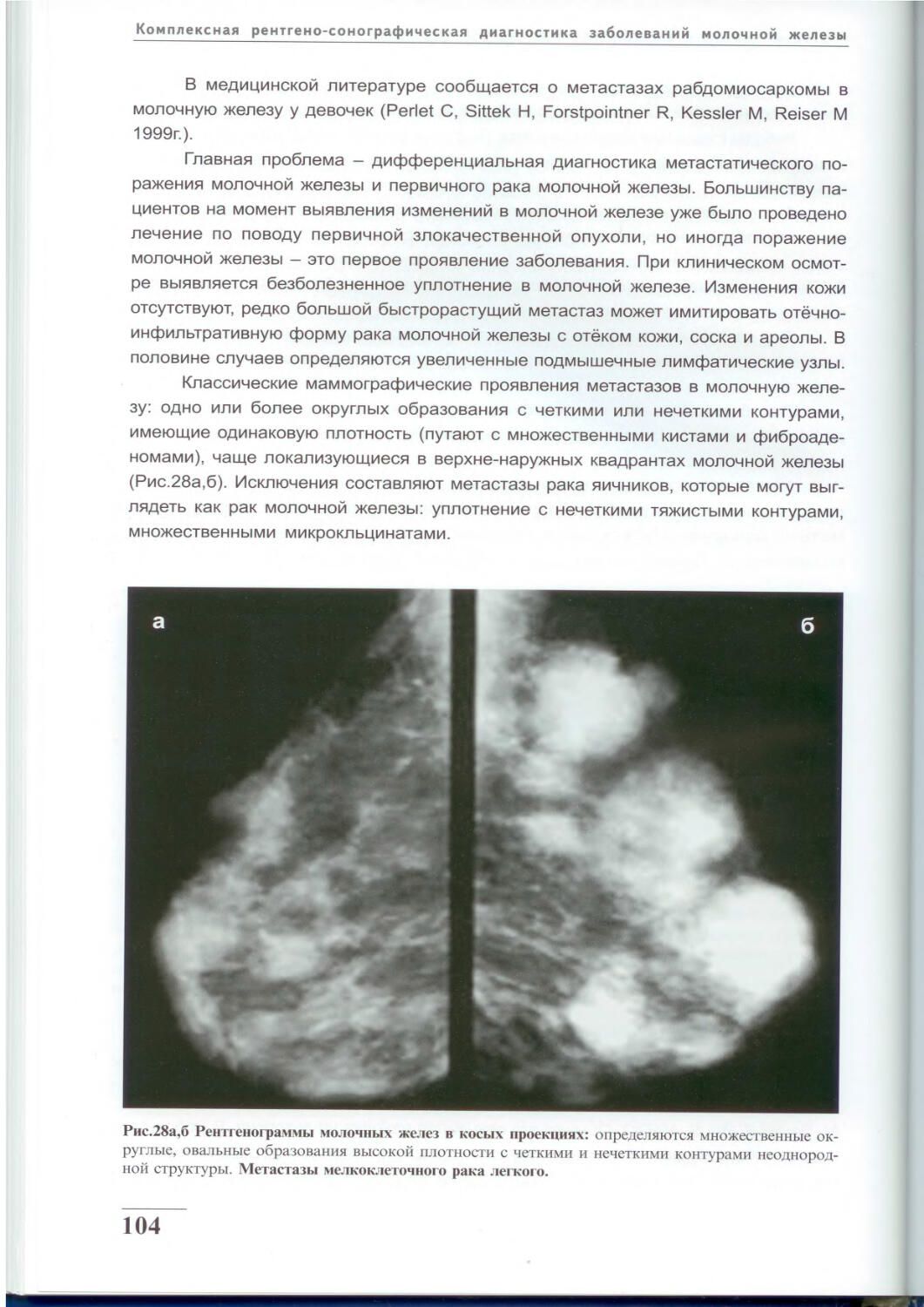 Корженкова маммография