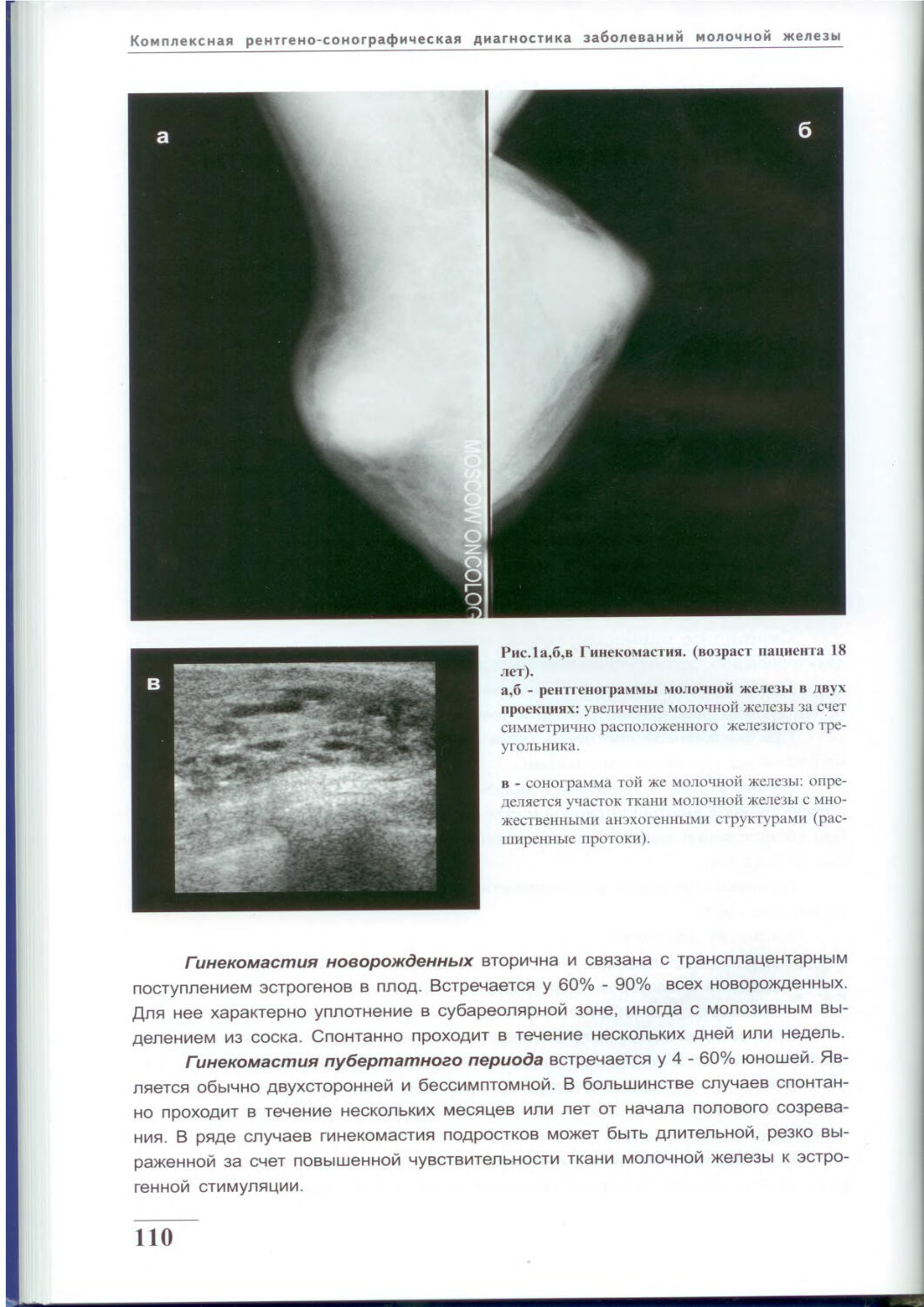Маммография молочных желез с патологией