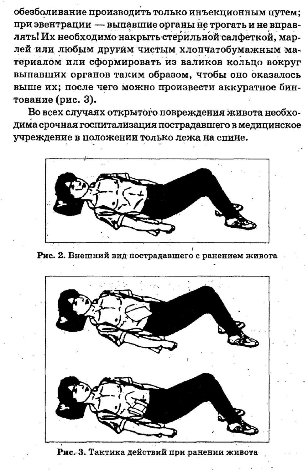 Синдром повреждения органов брюшной полости. Ранение брюшной полости первая помощь. ПМП при ранении живота. Первая врачебная помощь при ранении брюшной полости.