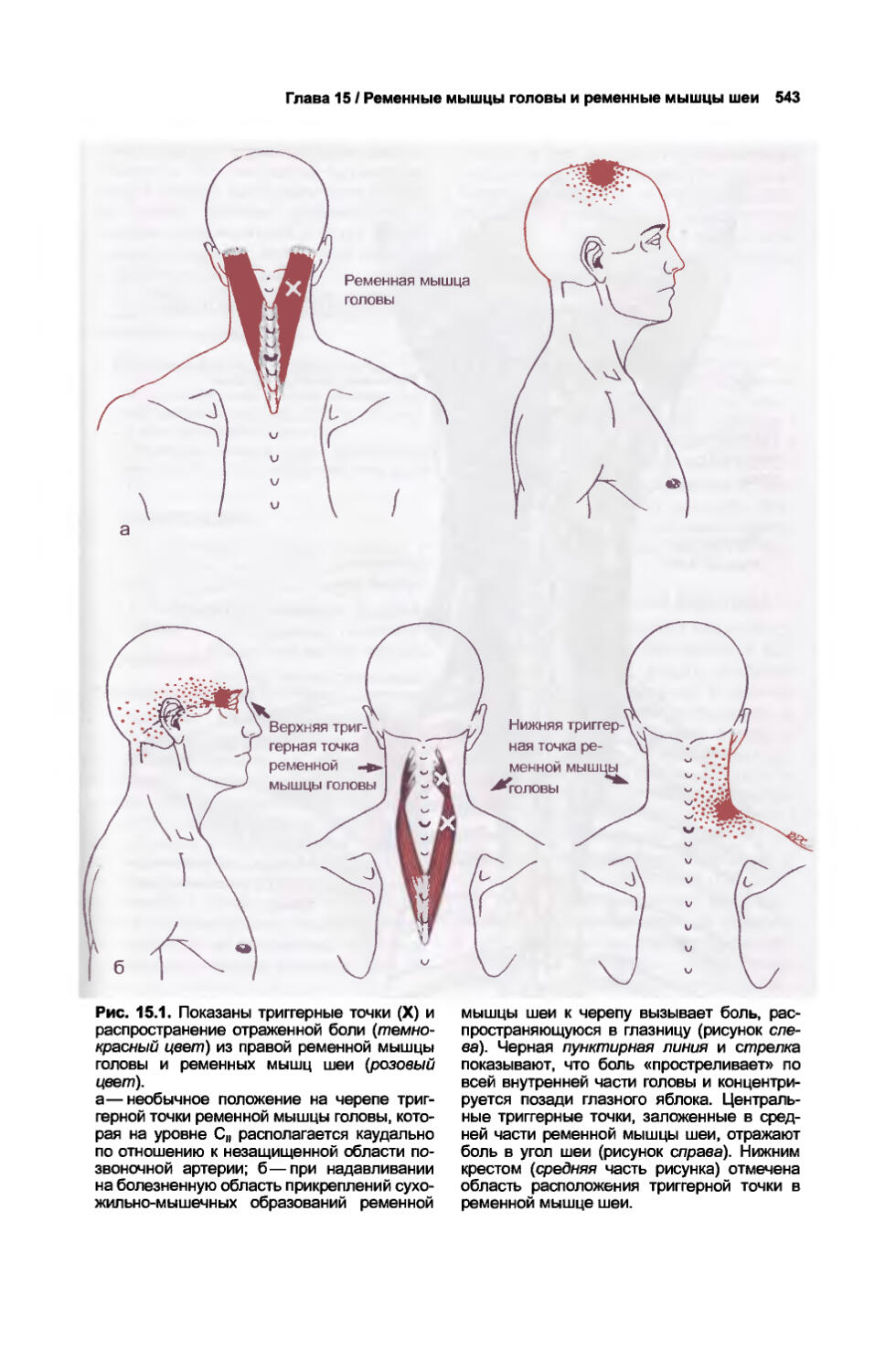 Миофасциальные дисфункции. Миофасциальные триггерные точки головы. Массаж ременной мышцы головы и шеи. Карта триггерных точек с отраженными болями. Фото верхней половины туловища.