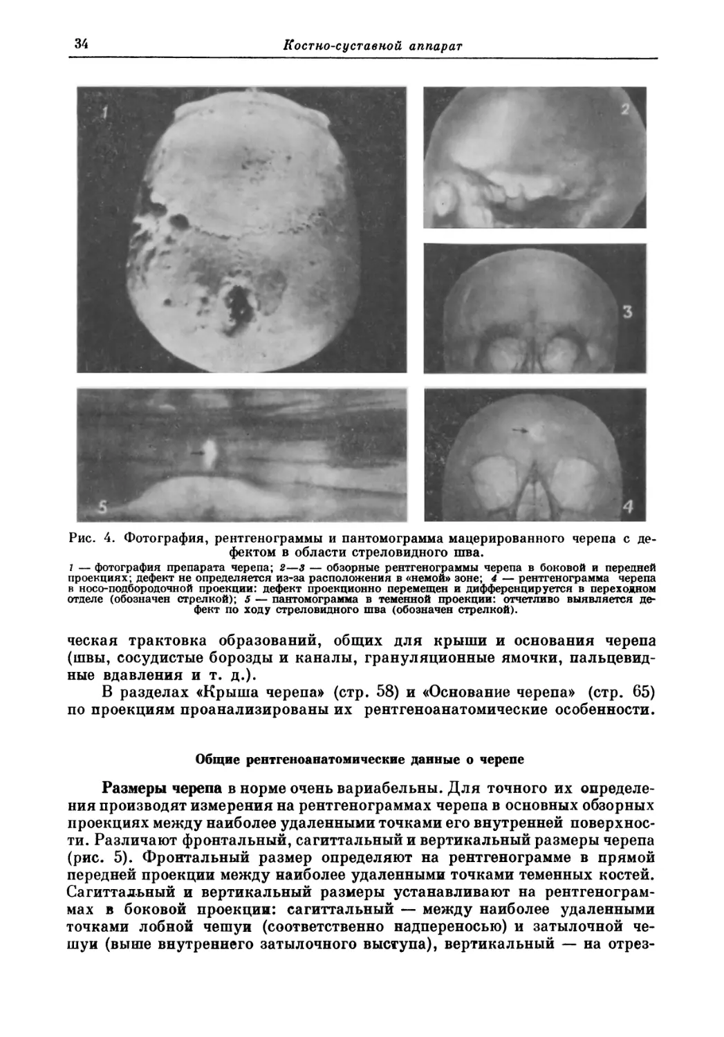 Общие рентгеноанатомические данные о черепе