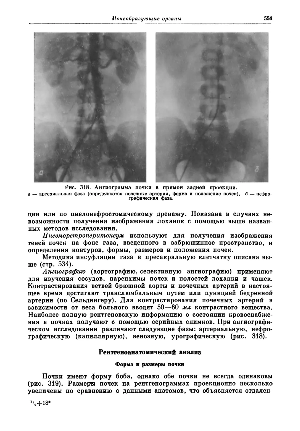 Рентгеноанатомический анализ
Форма и размеры почки