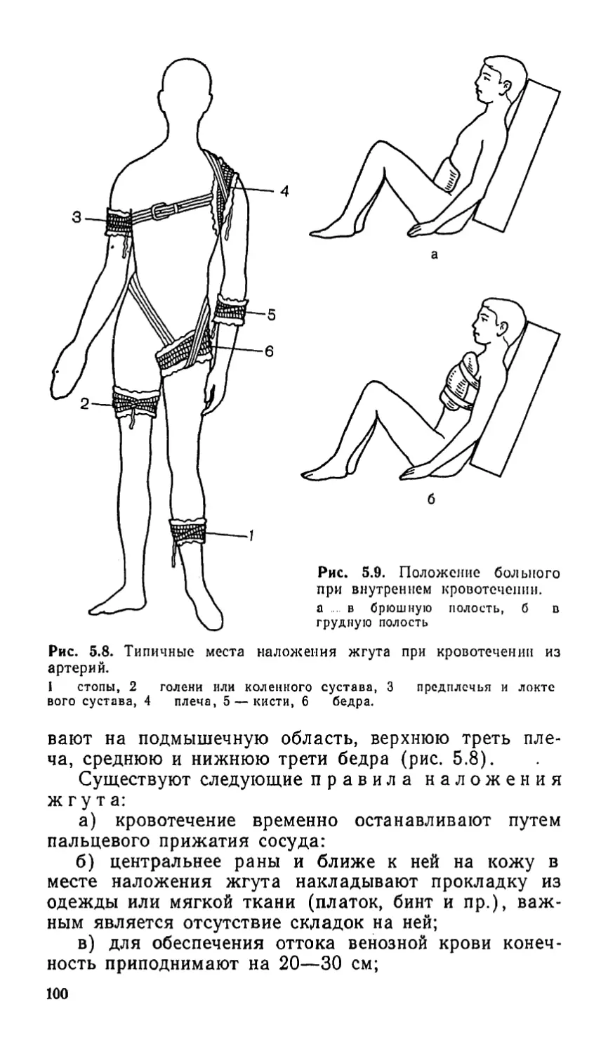 Внутренние кровотечения