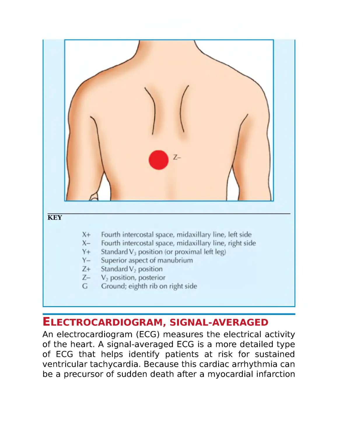 Electrocardiogram, signal-averaged