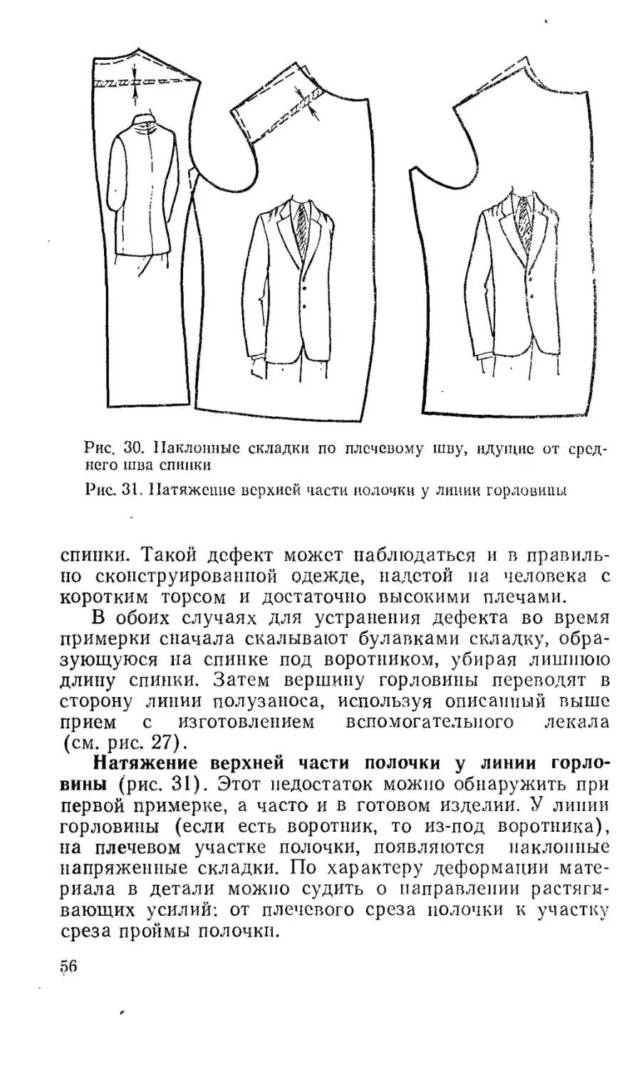 Дефекты плечевого шва