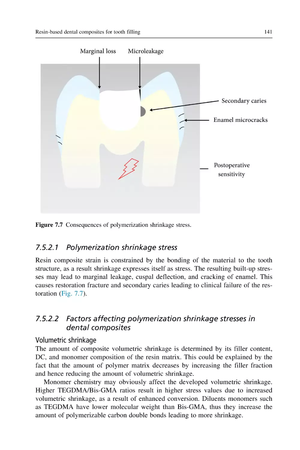 7.5.2.1 Polymerization shrinkage stress
7.5.2.2 Factors affecting polymerization shrinkage stresses in dental composites
Volumetric shrinkage