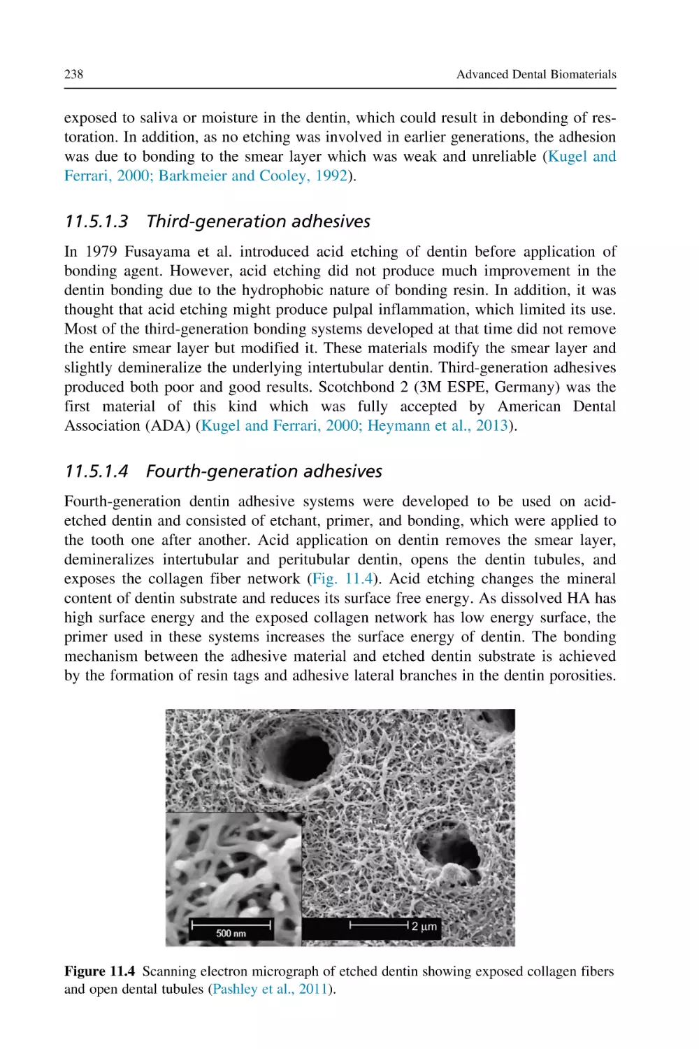 11.5.1.3 Third-generation adhesives
11.5.1.4 Fourth-generation adhesives