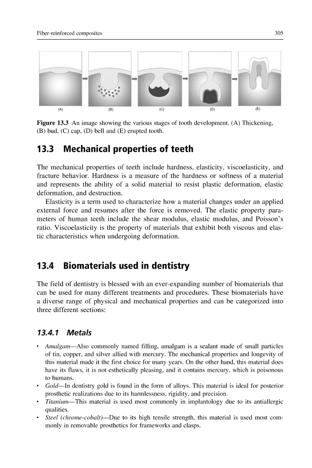 13.3 Mechanical properties of teeth
13.4 Biomaterials used in dentistry
13.4.1 Metals