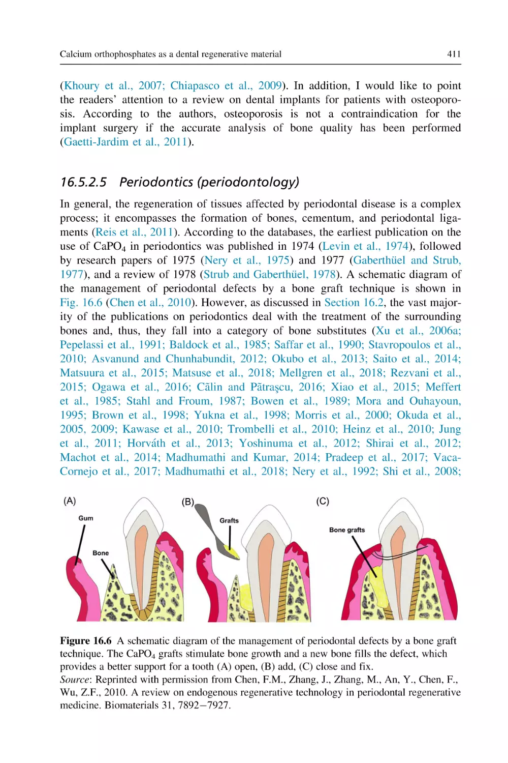 16.5.2.5 Periodontics (periodontology)