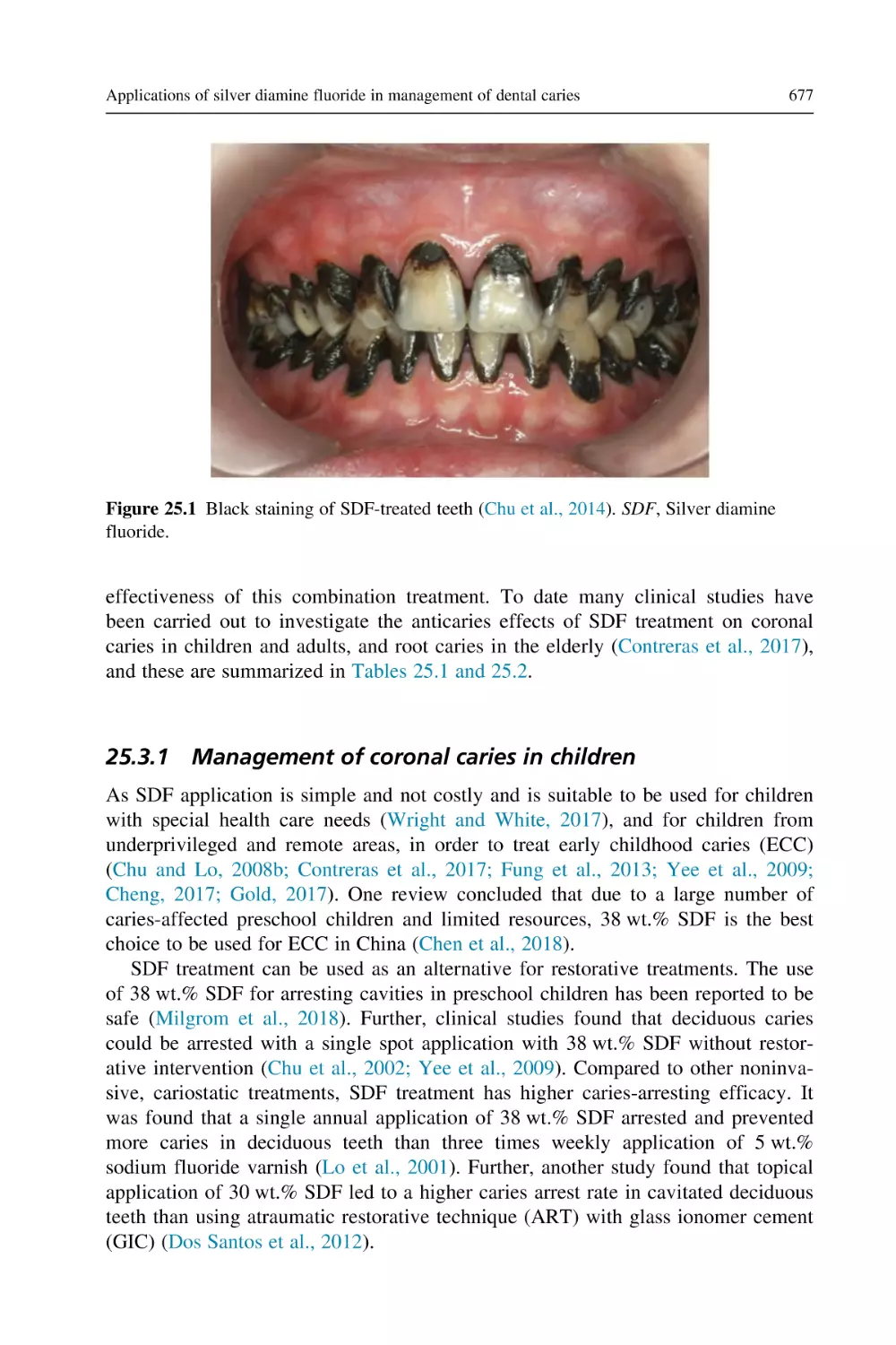 25.3.1 Management of coronal caries in children