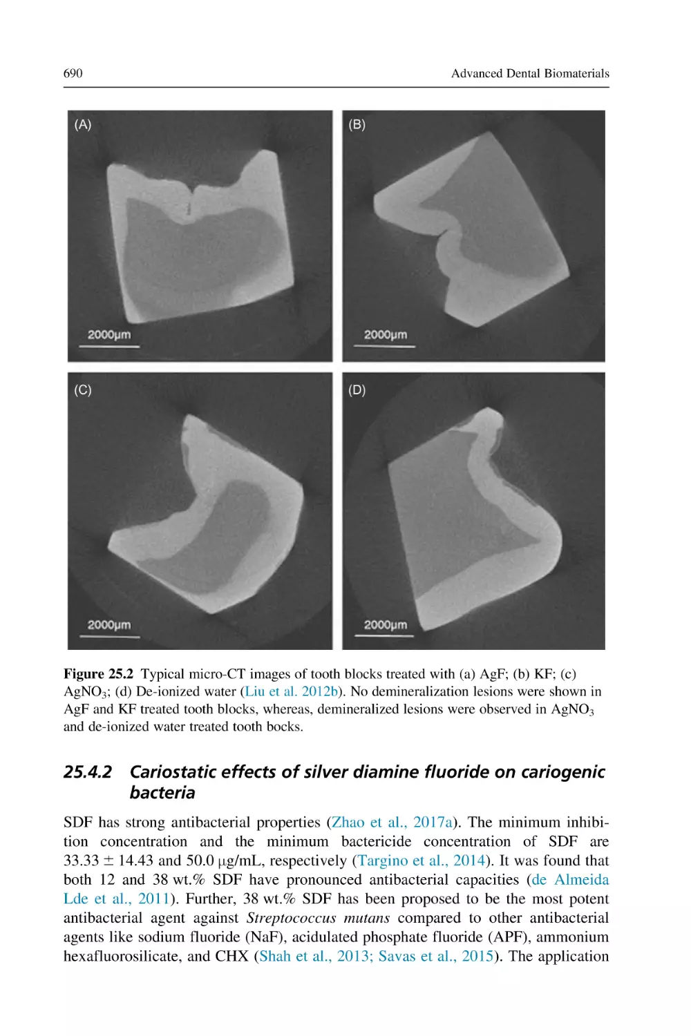 25.4.2 Cariostatic effects of silver diamine fluoride on cariogenic bacteria