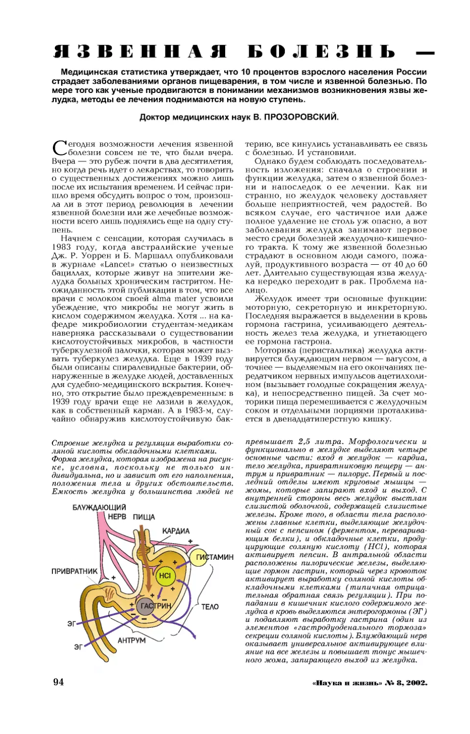 В. ПРОЗОРОВСКИЙ, докт. мед. наук — Язвенная болезнь — ступени лечения