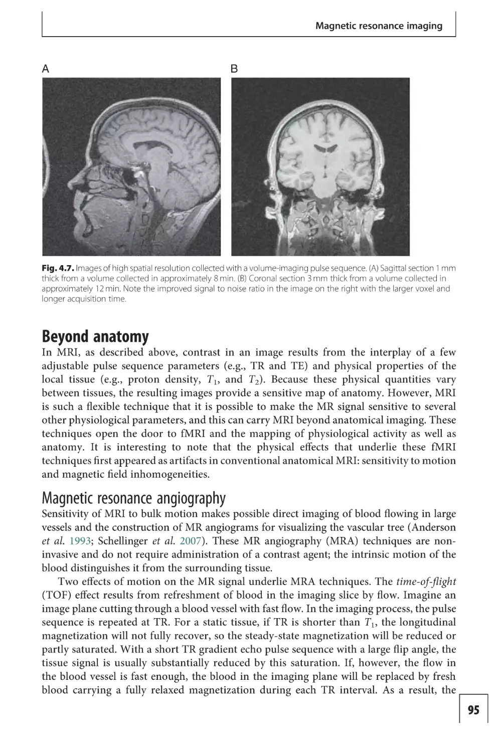 Beyond anatomy
Magnetic resonance angiography