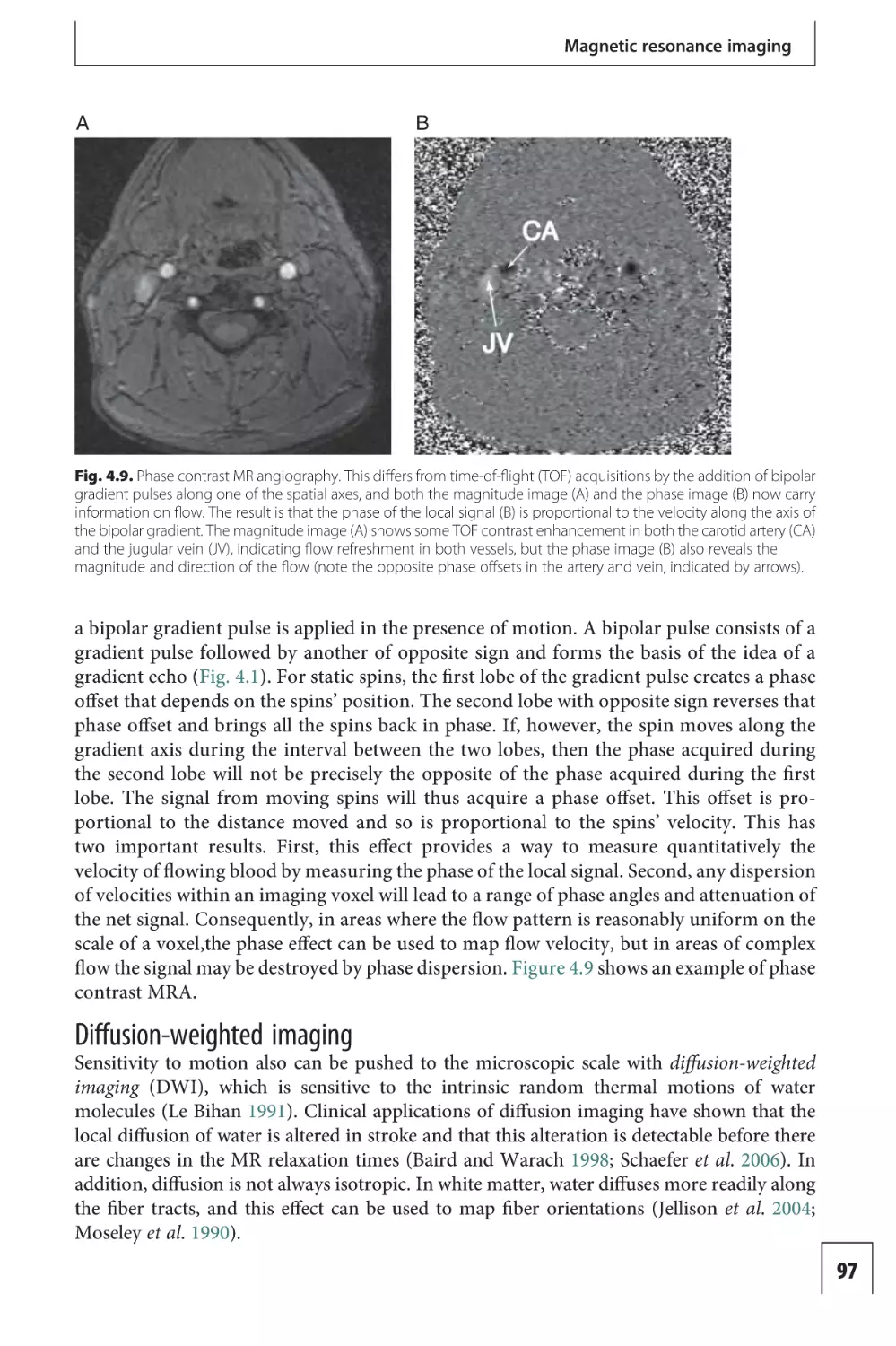 Diffusion-weighted imaging