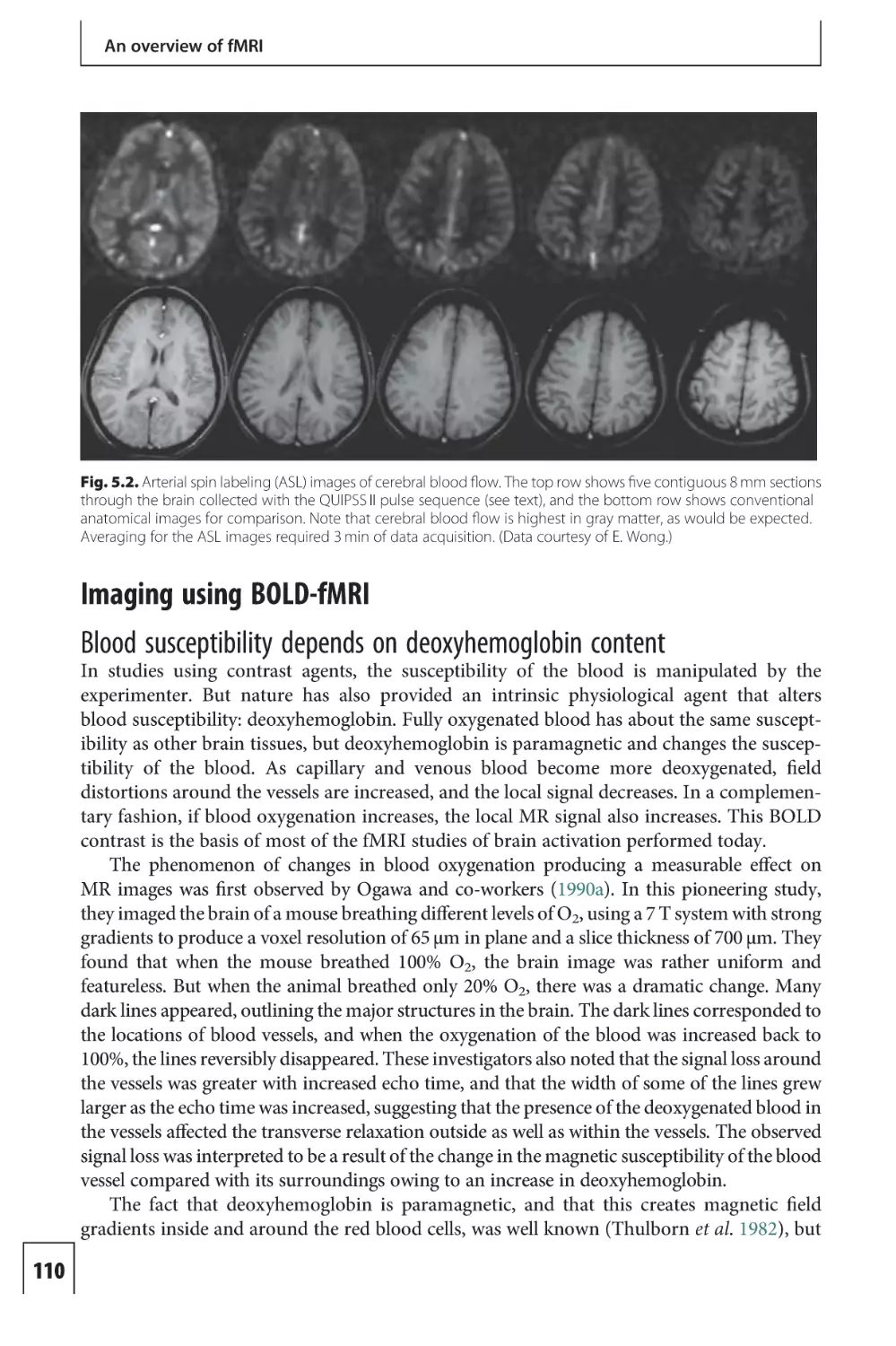 Imaging using BOLD-fMRI
Blood susceptibility depends on deoxyhemoglobin content