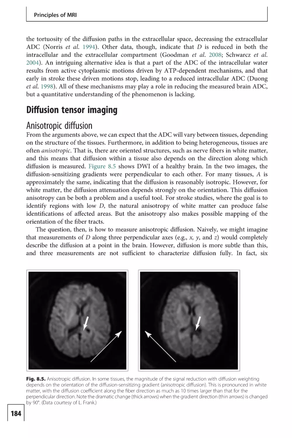 Diffusion tensor imaging
Anisotropic diffusion