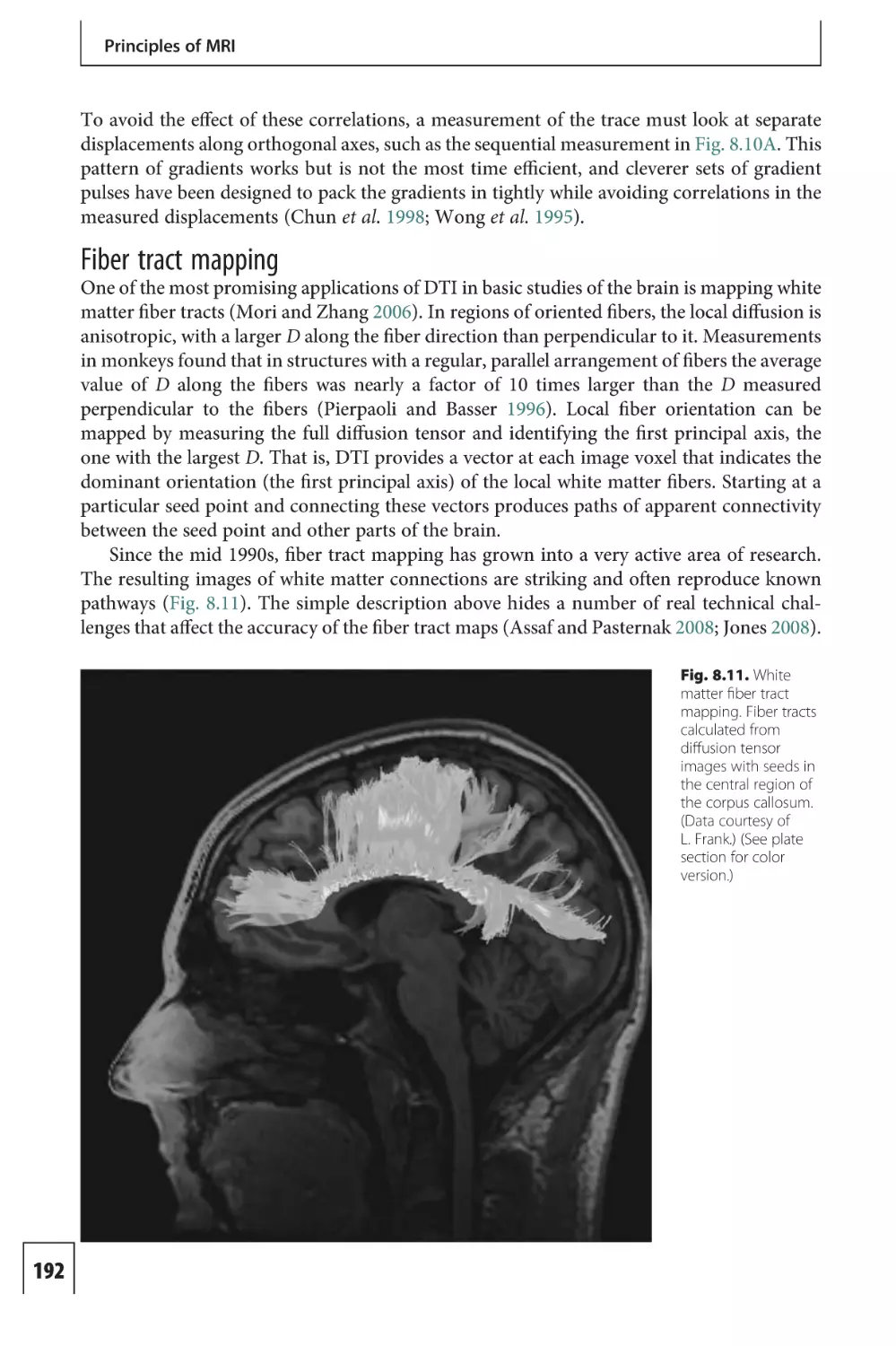 Fiber tract mapping