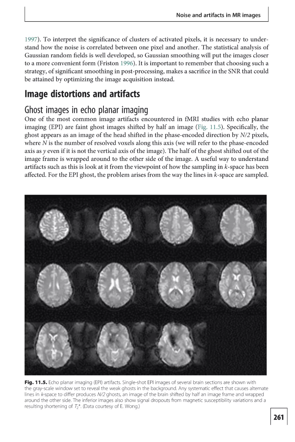 Image distortions and artifacts
Ghost images in echo planar imaging