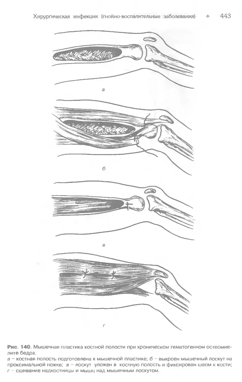 Гостищев общая хирургия читать. Гостищев в.к. "общая хирургия". Общая хирургия учебник Гостищев. Общая хирургия рис. 181, б, в, 182.