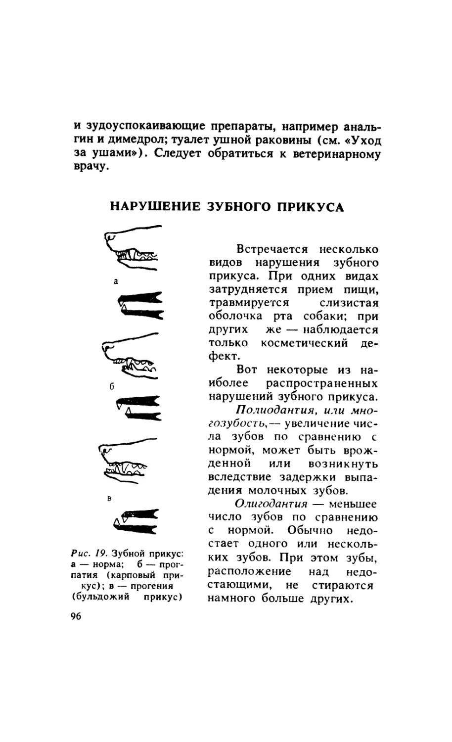 5.5. Нарушение зубного прикуса