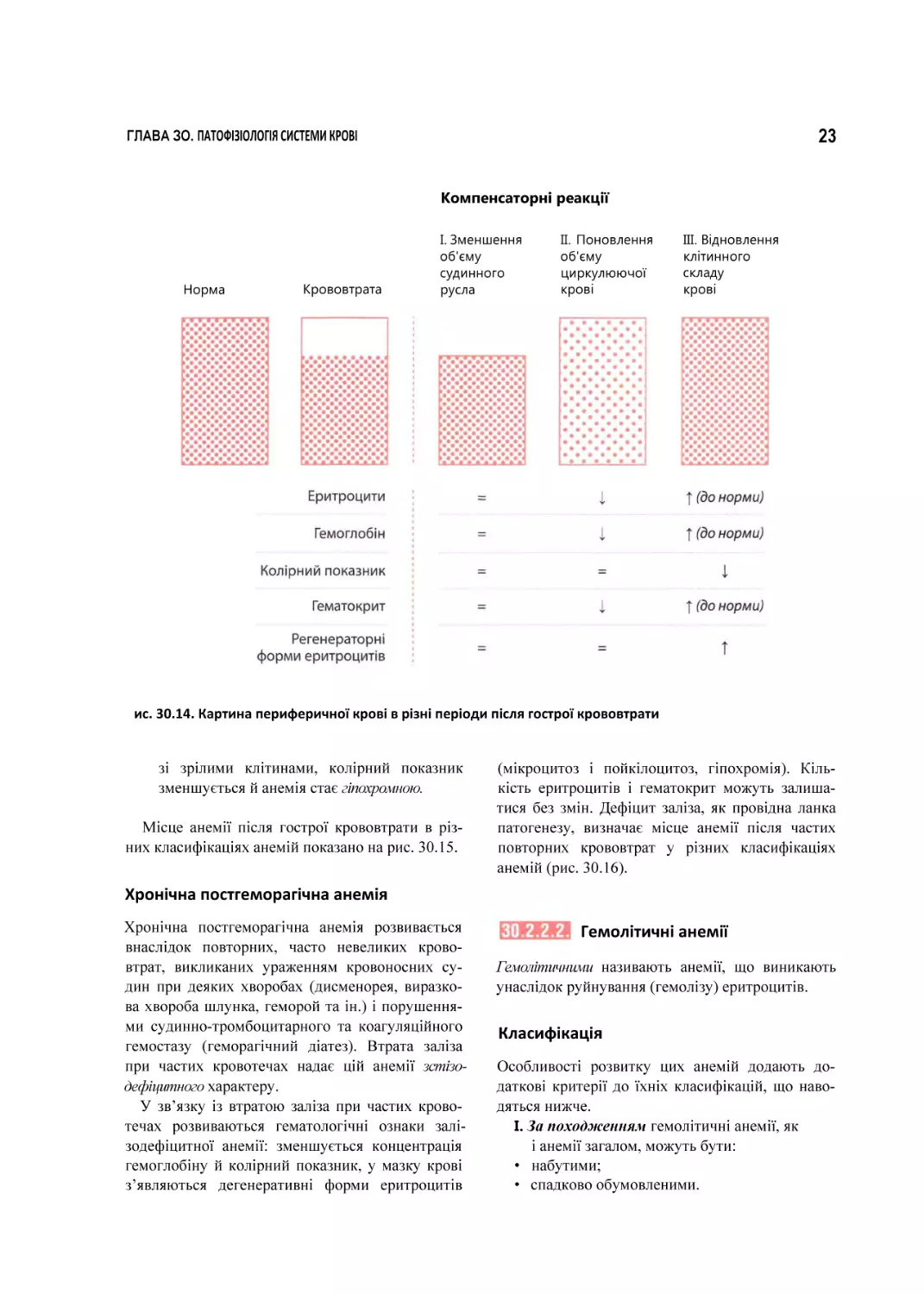 ис. 30.14. Картина периферичної крові в різні періоди після гострої крововтрати
Хронічна постгеморагічна анемія
Гемолітичні анемії
Класифікація