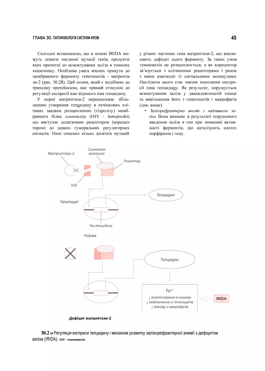 З0.2 о Регуляція експреси гепцидину і механізм розвитку залізорефрактерної анемії з дефіцитом заліза (IRIDA). HJV - гемоювелін