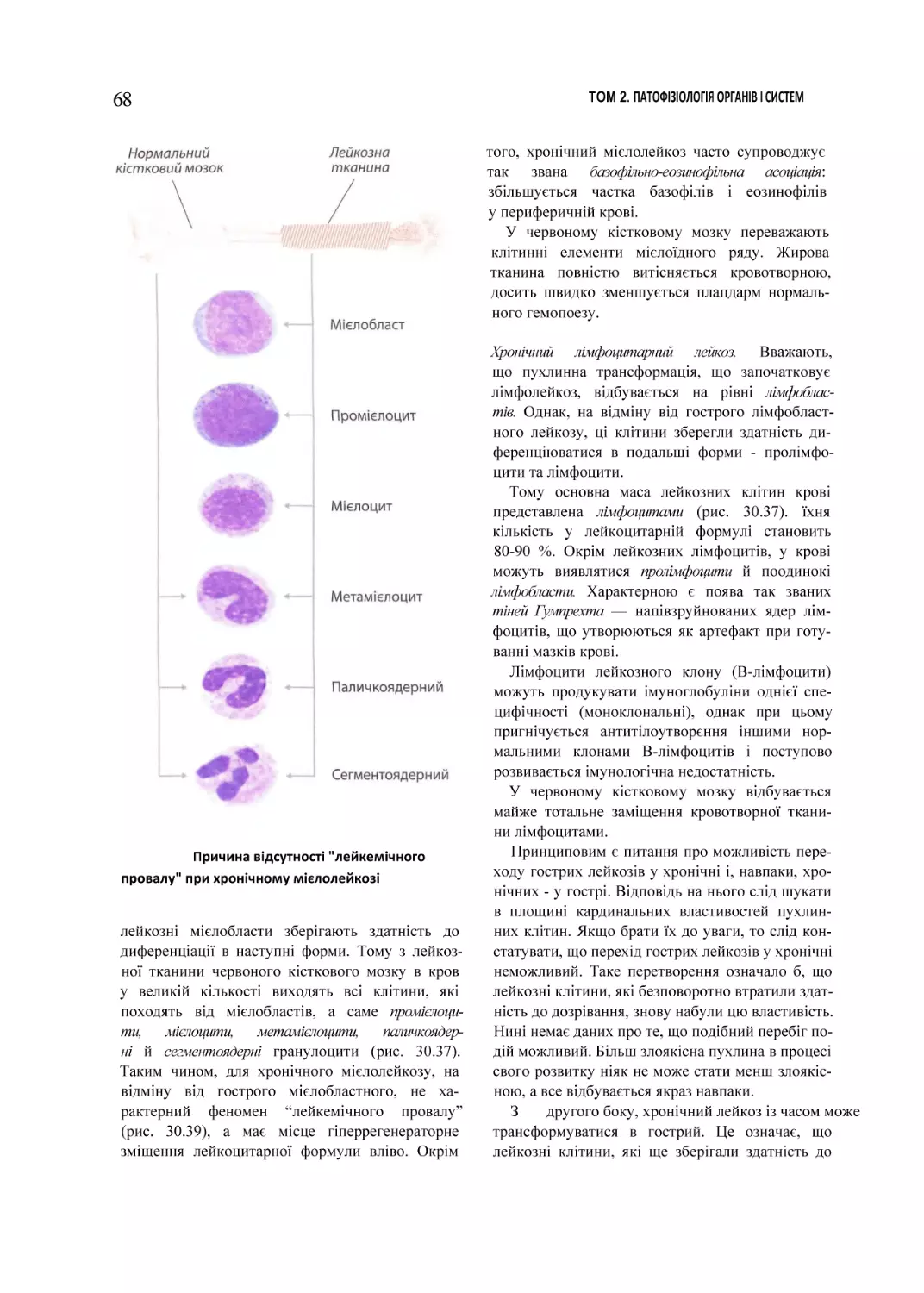 Причина відсутності "лейкемічного провалу" при хронічному мієлолейкозі