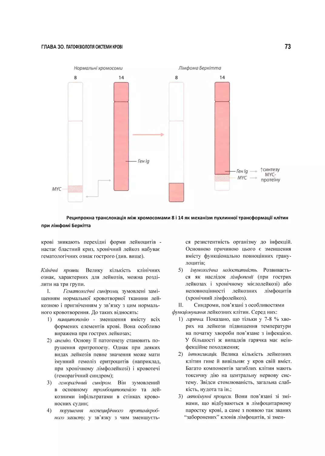 Реципрокна транслокація між хромосомами 8 і 14 як механізм пухлинної трансформації клітин при лімфомі Беркітта