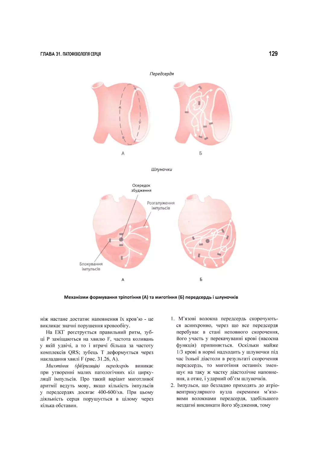 Механізми формування тріпотіння (А) та миготіння (Б) передсердь і шлуночків