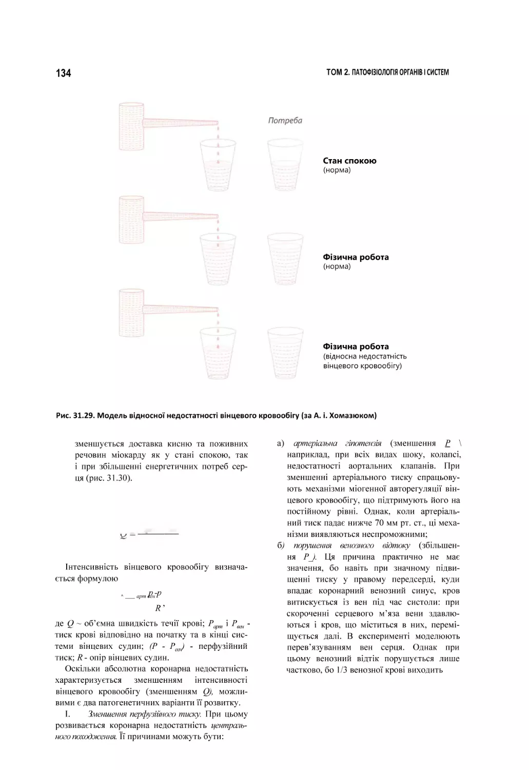 Рис. 31.29. Модель відносної недостатності вінцевого кровообігу (за А. і. Хомазюком)