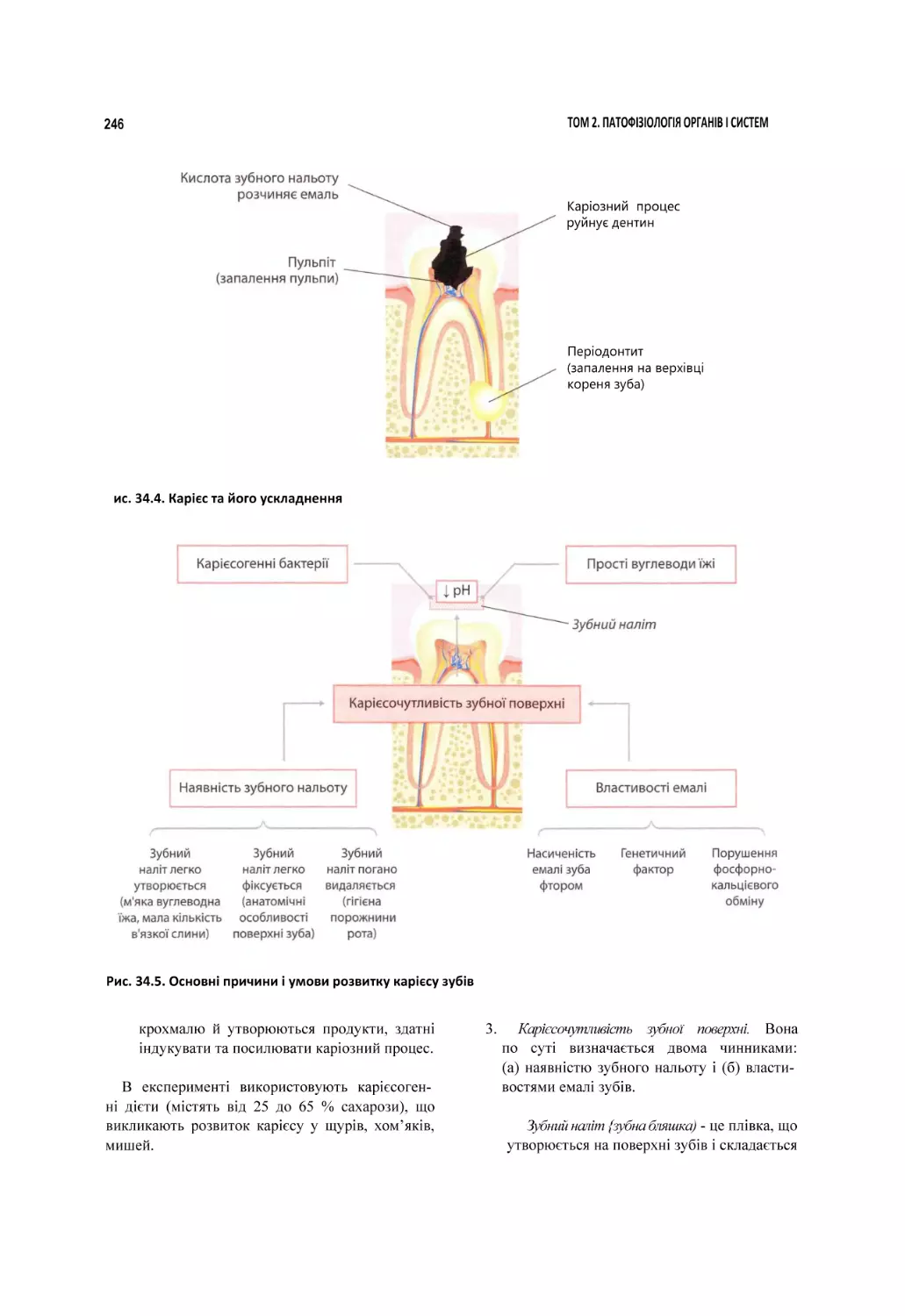 ис. 34.4. Карієс та його ускладнення
Рис. 34.5. Основні причини і умови розвитку карієсу зубів