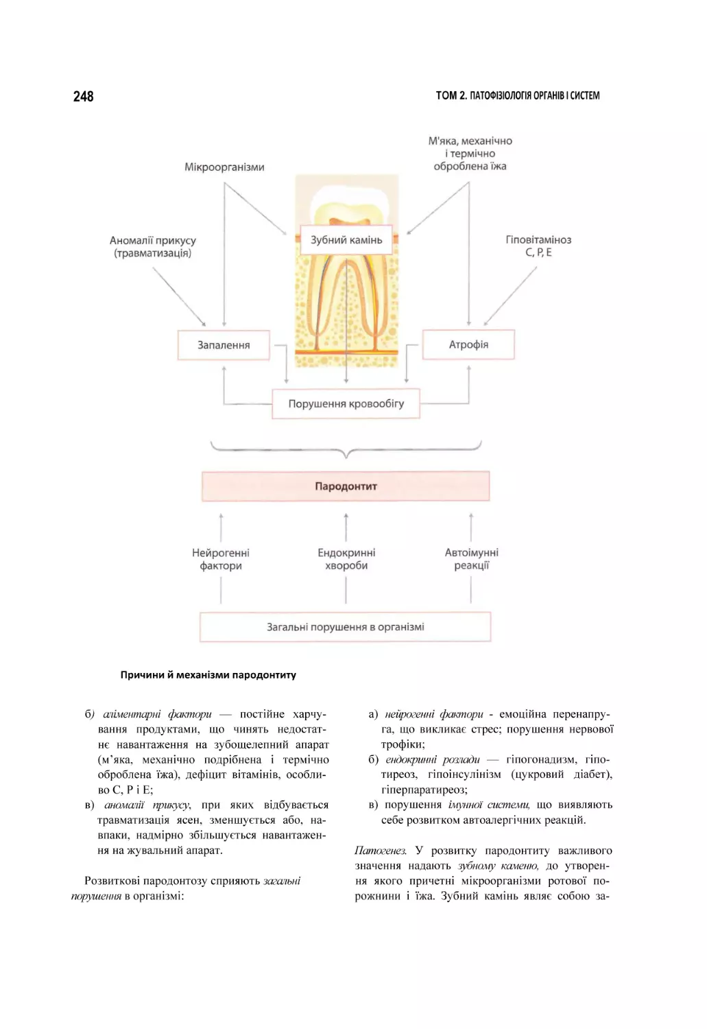 Причини й механізми пародонтиту