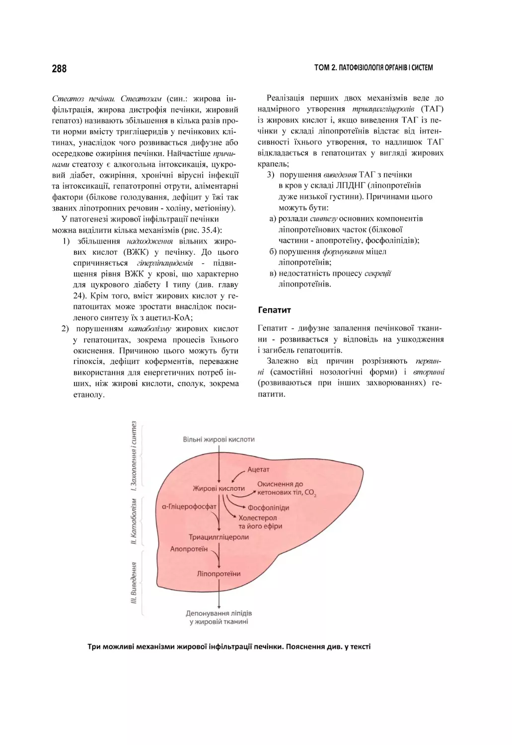 Гепатит
Три можливі механізми жирової інфільтрації печінки. Пояснення див. у тексті