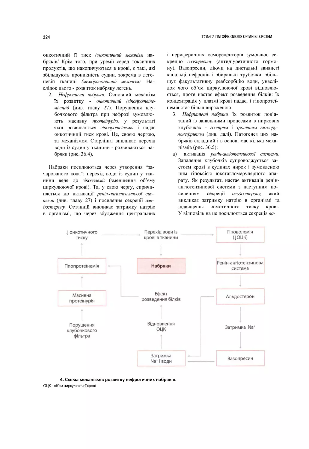 4. Схема механізмів розвитку нефротичних набряків.