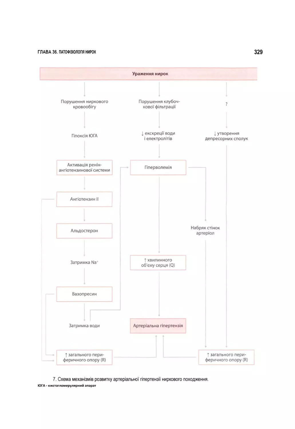 7. Схема механізмів розвитку артеріальної гіпертензії ниркового походження. ЮГА - кжстагломерулярний апарат