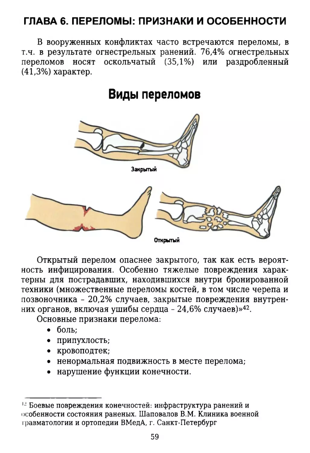 Глава 6. Переломы