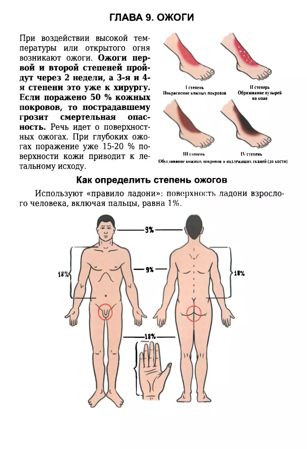 Глава 9. Ожоги