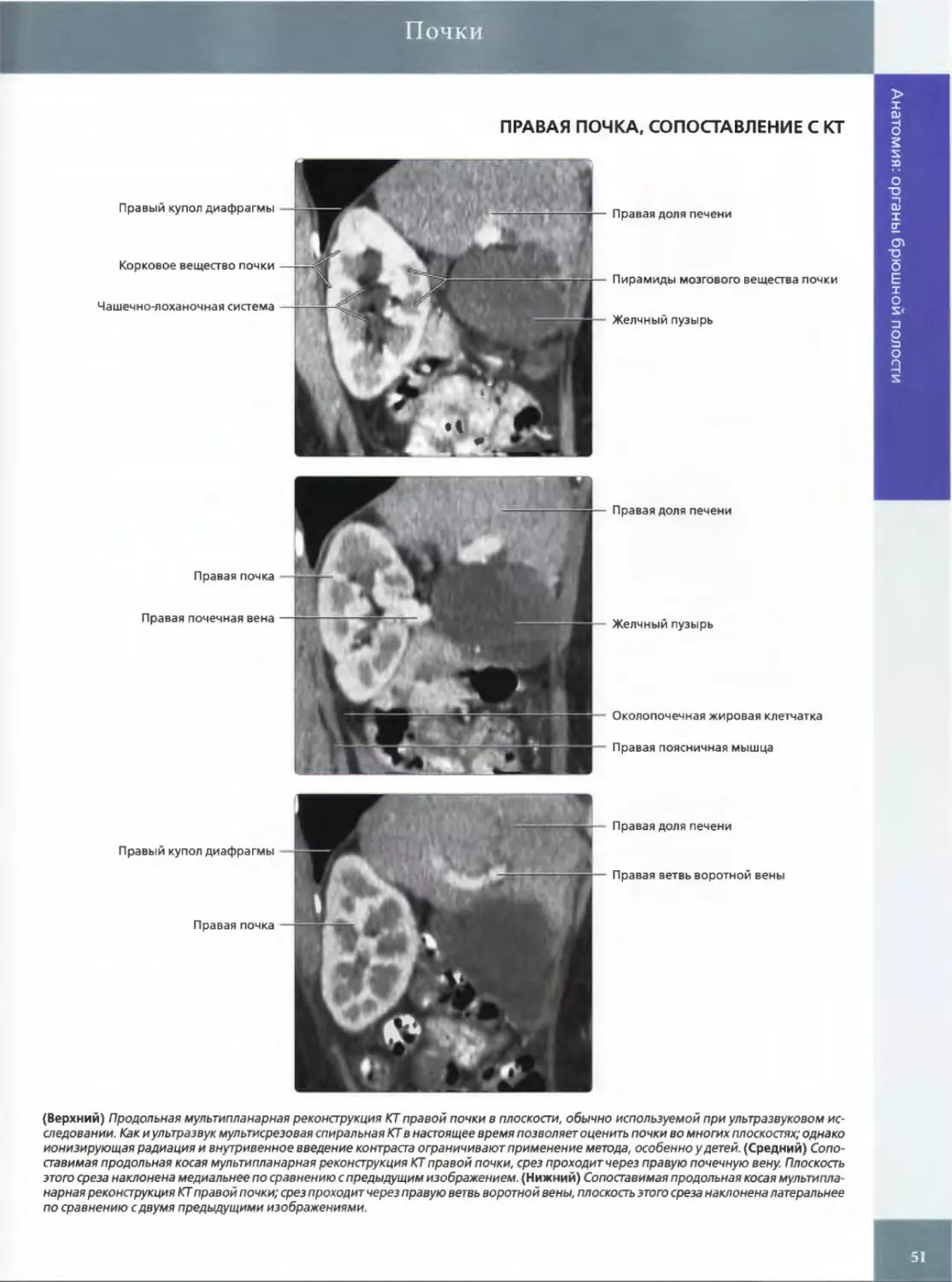 ПРАВАЯ ПОЧКА, СОПОСТАВЛЕНИЕ С КТ