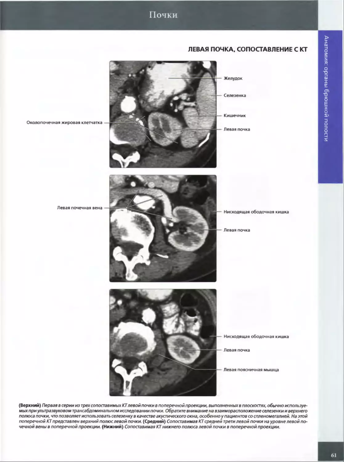 ЛЕВАЯ ПОЧКА, СОПОСТАВЛЕНИЕ С КТ