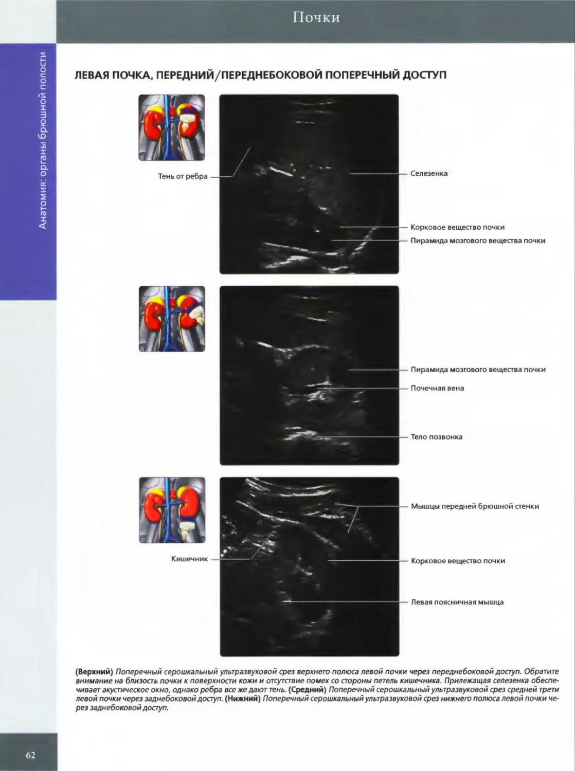 ЛЕВАЯ ПОЧКА, ПЕРЕДНИЙ/ПЕРЕДНЕБОКОВОЙ ПОПЕРЕЧНЫЙ ДОСТУП