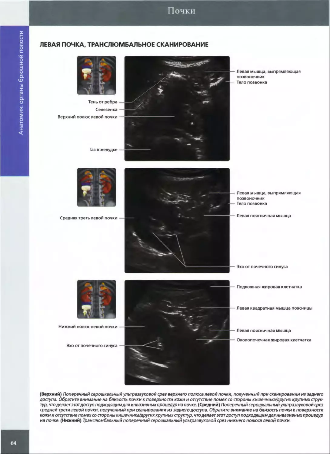ЛЕВАЯ ПОЧКА, ТРАНСЛЮМБАЛЬНОЕ СКАНИРОВАНИЕ