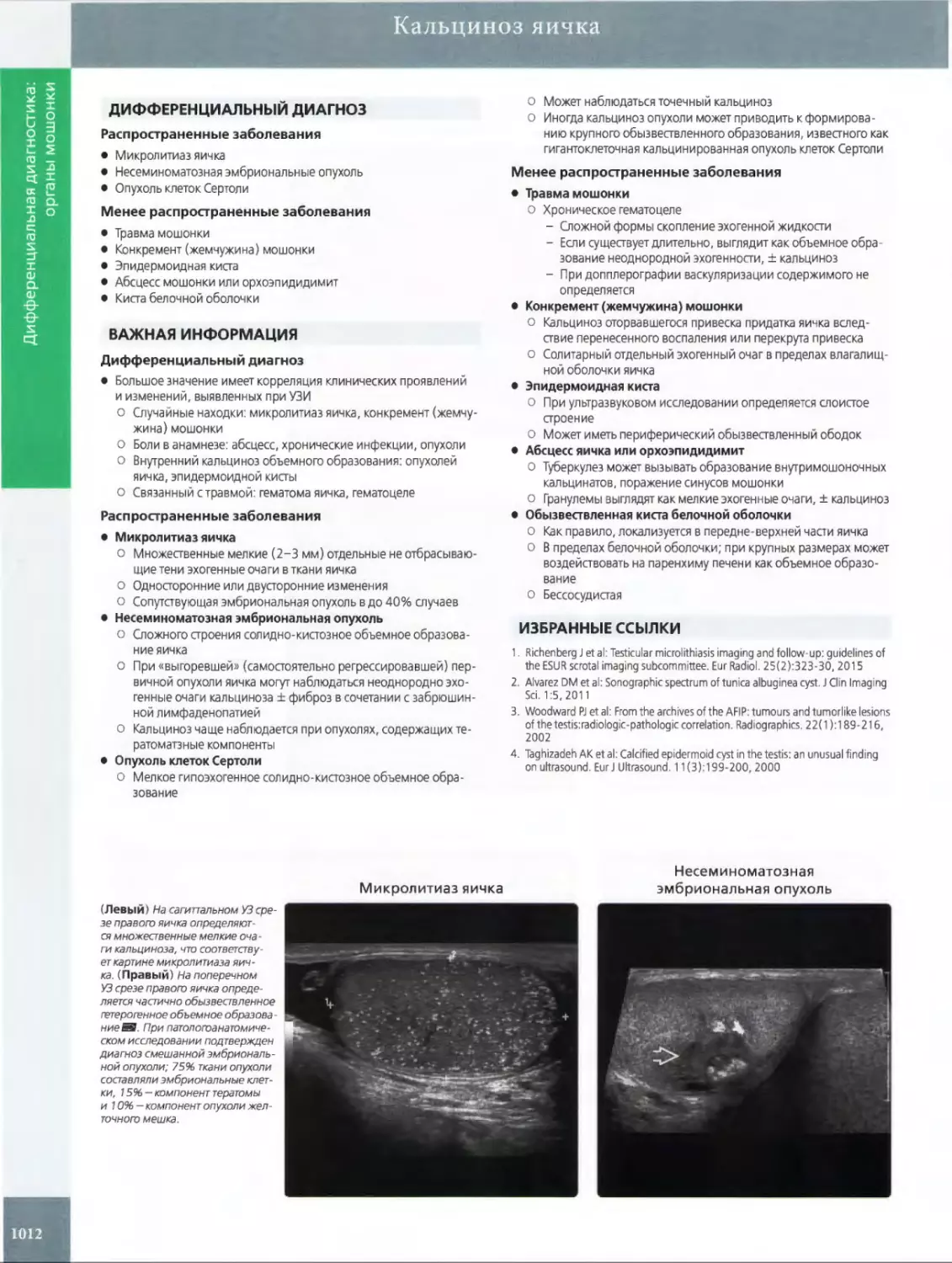 ДИФФЕРЕНЦИАЛЬНЫЙ ДИАГНОЗ
ВАЖНАЯ ИНФОРМАЦИЯ
•	Микролитиаз яичка
•	Несеминоматозная эмбриональная опухоль
•	Опухоль клеток Сертоли
•	Травма мошонки
•	Конкремент (жемчужина) мошонки
•	Эпидермоидная киста
•	Абсцесс яичка или орхоэпидидимит
•	Обызвествленная киста белочной оболочки
ИЗБРАННЫЕ ССЫЛКИ