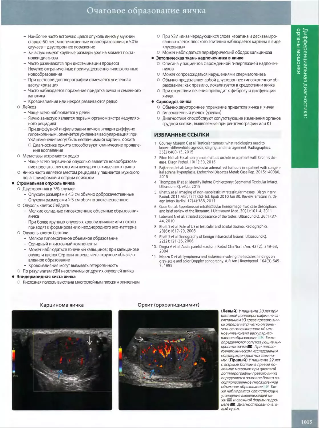 •	Эпидермоидная киста яичка
•	Эктопическая ткань надпочечника в яичке
•	Саркоидозяичка
ИЗБРАННЫЕ ССЫЛКИ