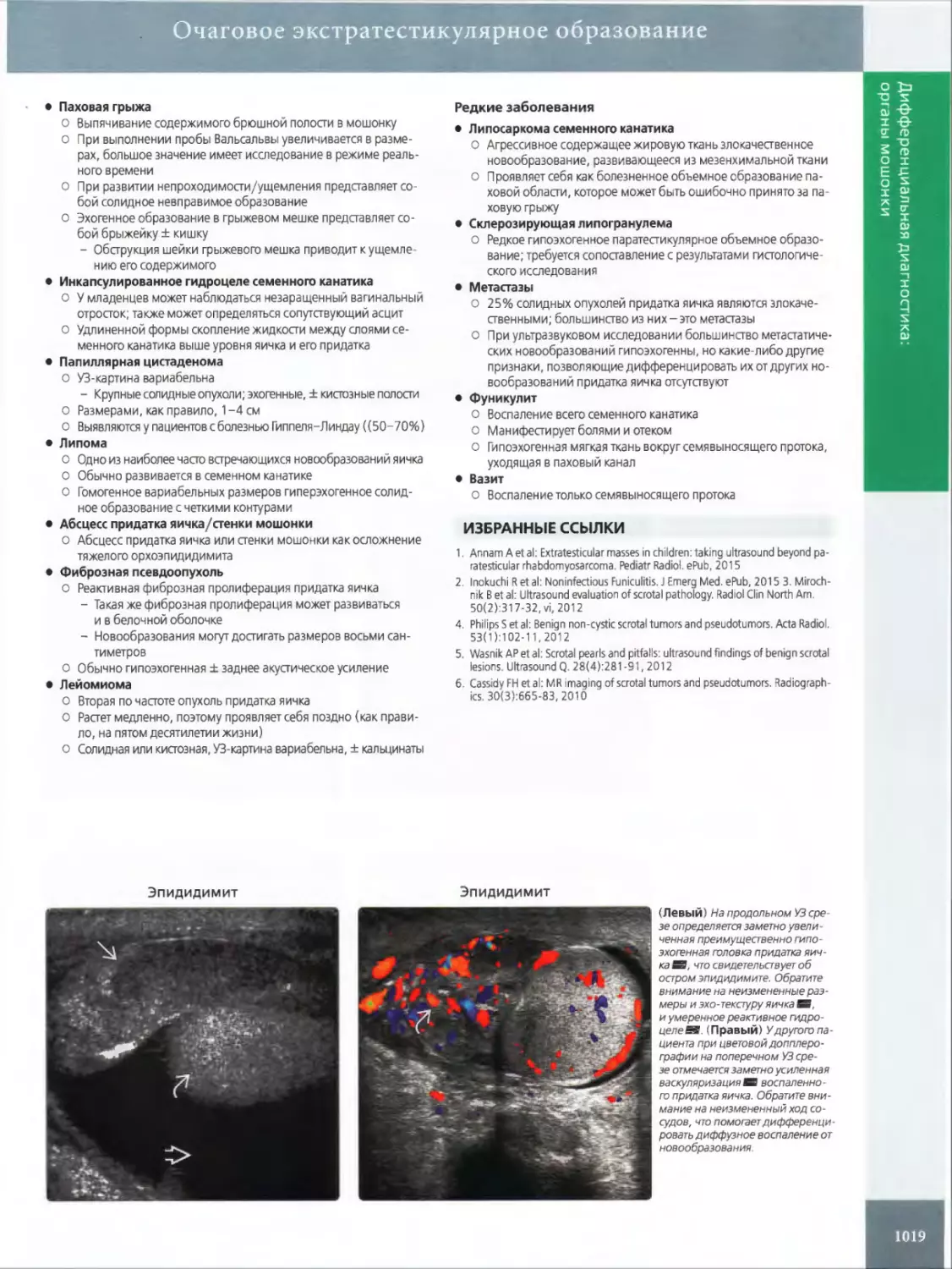 •	Паховая грыжа
•	Инкапсулированное гидроцеле семенного канатика
•	Липома
•	Абсцесс придатка яичка/стенки мошонки
•	Фиброзная псевдоопухоль
•	Лейомиома
•	Липосаркома семенного канатика
•	Скперозирующая липогранулема
•	Метастазы
•	Фуникулит
•	Вазит