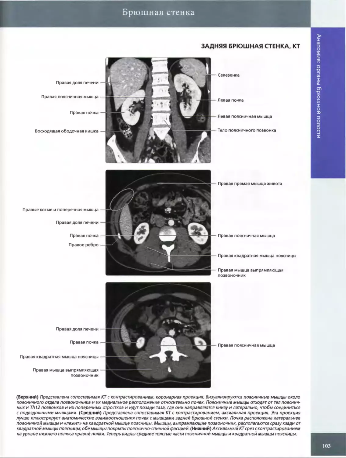 ЗАДНЯЯ БРЮШНАЯ СТЕНКА, КТ